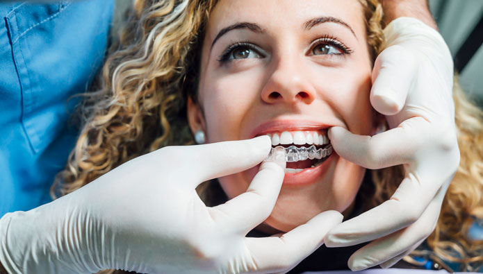  How do Angel Aligners work?