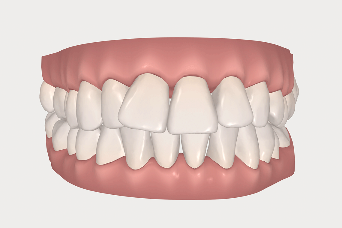 Ready to see your future smile? Ready to see your future smile?