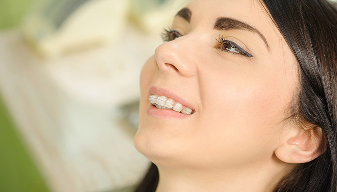 3 benefits of ceramic braces